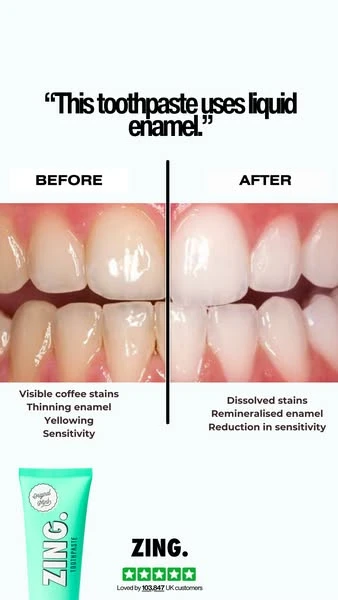 Ecom Bench ad: toothpaste before and after